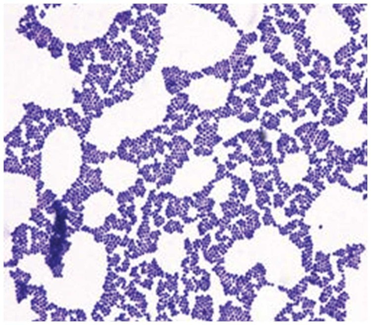 Стафилококк ауреус