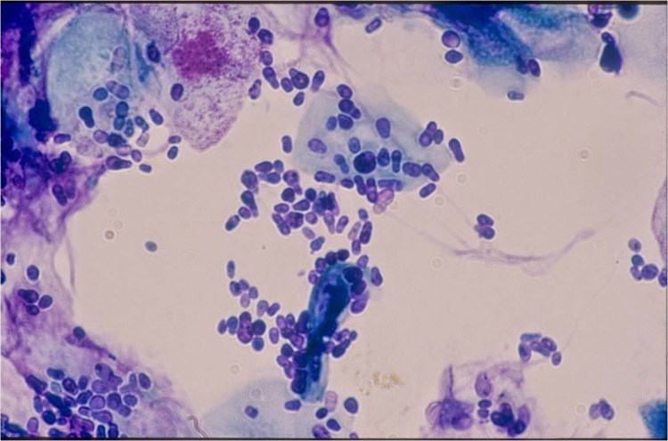 Malassezia FURFUR под микроскопом