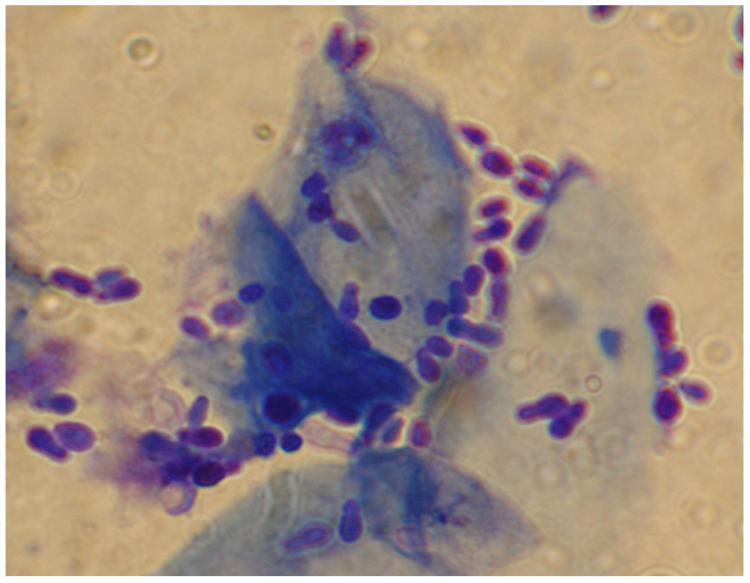 Candida albicans и лептотрикс под микроскопом