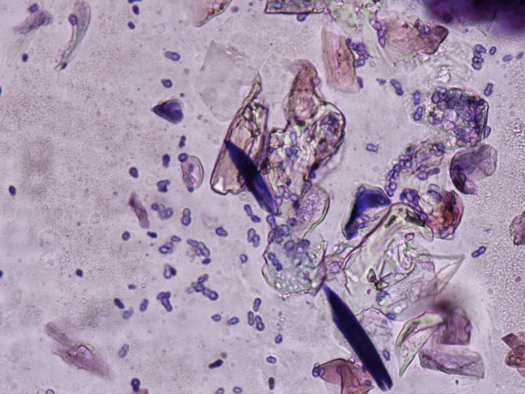 Малассезия микроскопия