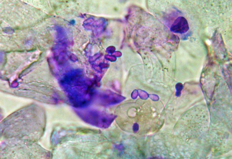 Окраска мазков дифф-Квик.