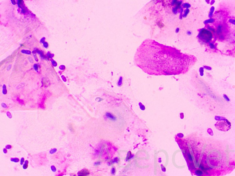 Малассезиозный отит капли