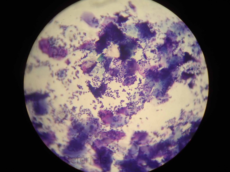 Дрожжеподобный грибок Malassezia