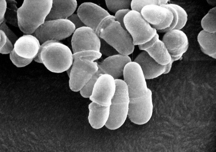 Уропатогенный хромагар