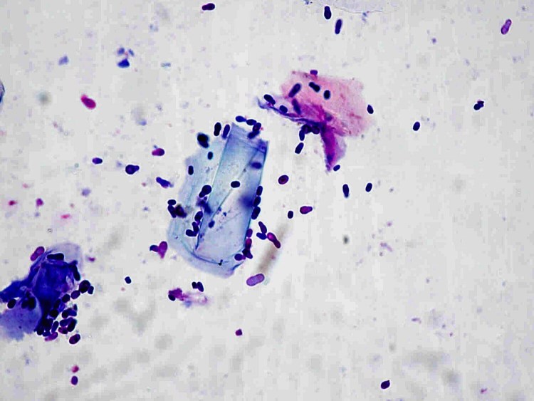 Малассезия микроскопия