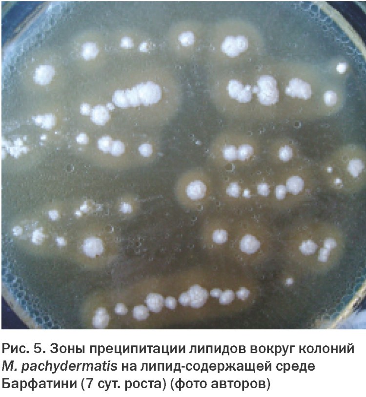 Рисунок колоний Malassezia FURFUR