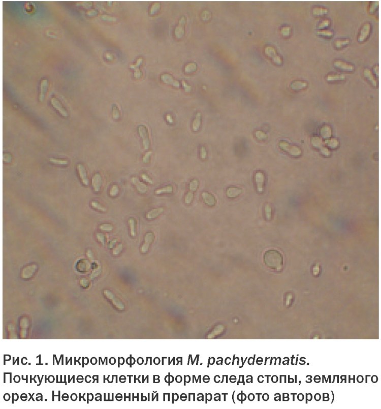 Lactobacillus Acidophilus под микроскопом