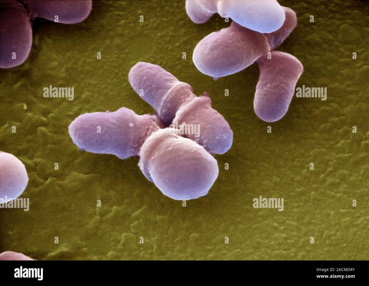 Трихофития микроскопия