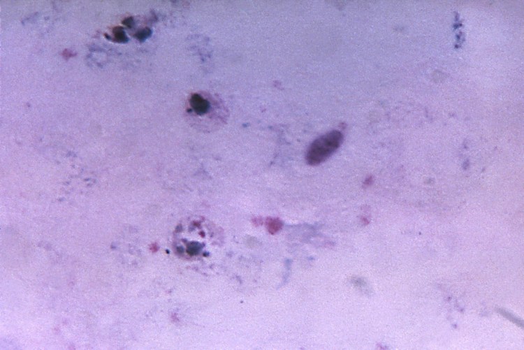 Actinobacillus actinomycetemcomitans морфология