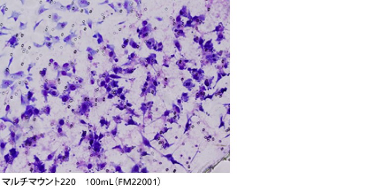 Малассезия мазок микроскопия
