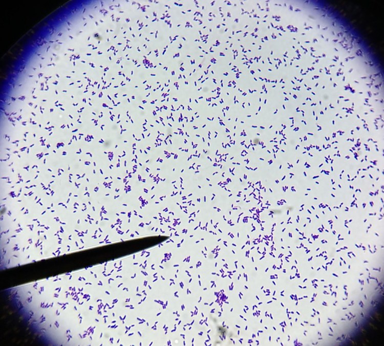 Грибок малассезия (Malassezia)