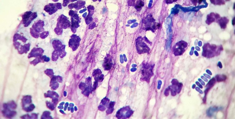 Грибы рода Malassezia у человека