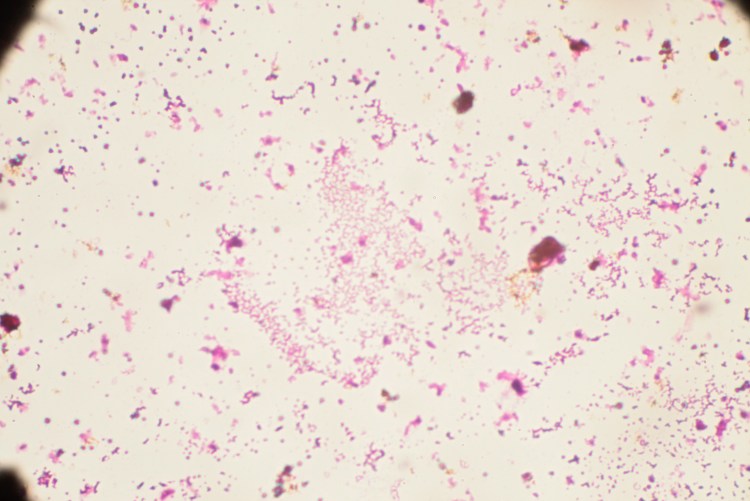 Стафилококк ауреус микроскопия