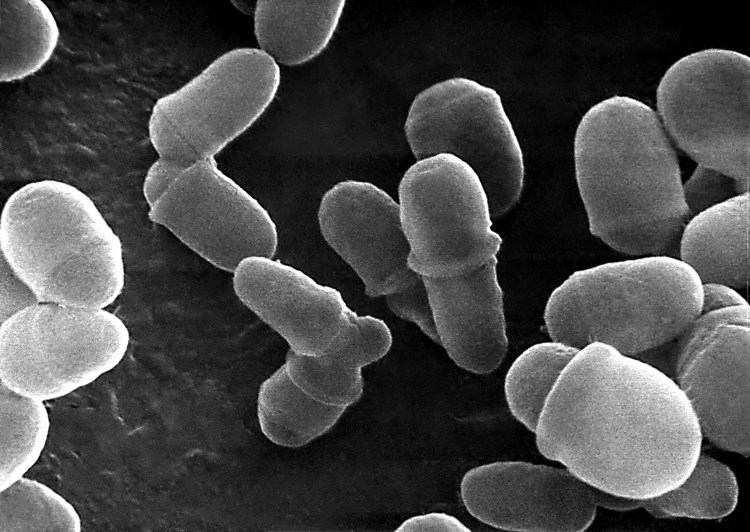 Грибок рода малассезия