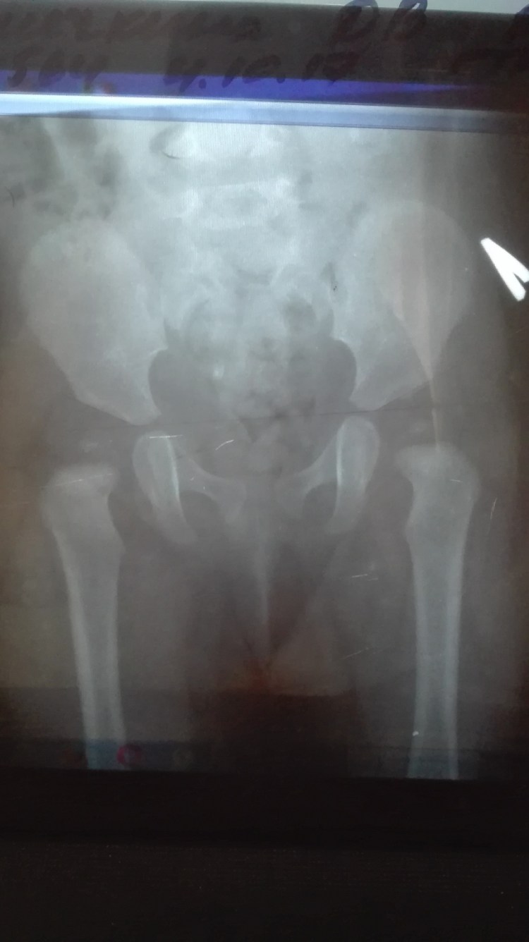 Как лечить мочекаменную болезнь у кошек