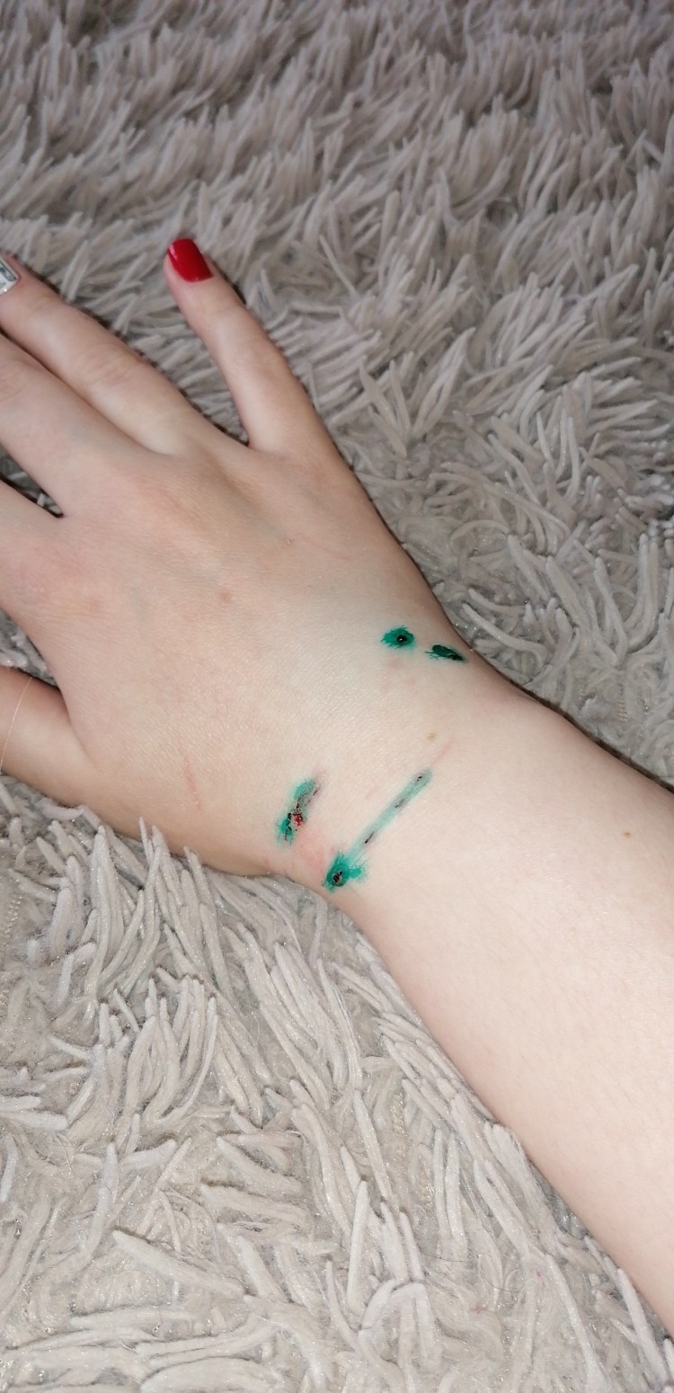 Милиарный дерматит у кота