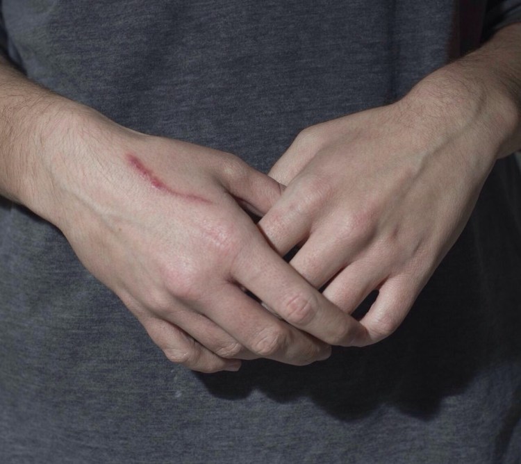 Периоды болезни бешенства у животных