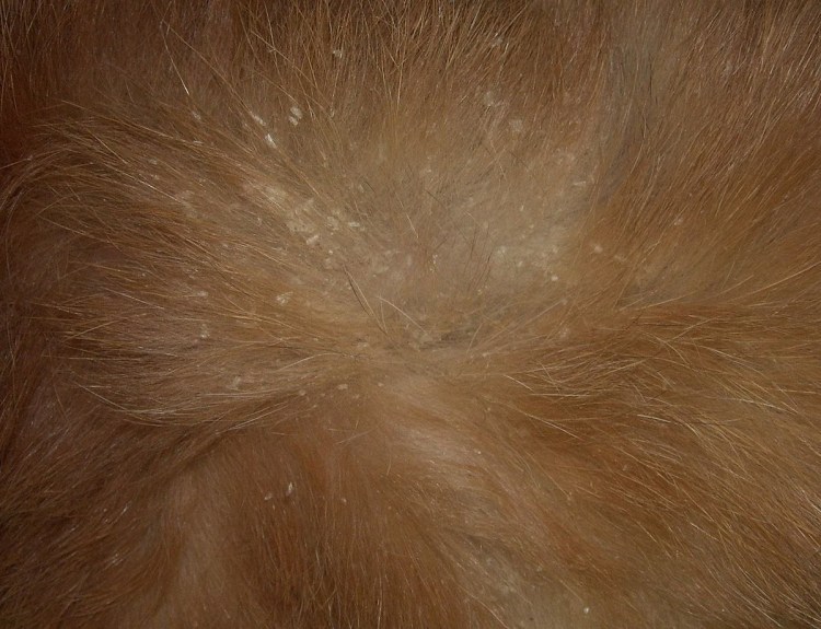 Хейлетиеллез (отрубевидная чесотка)