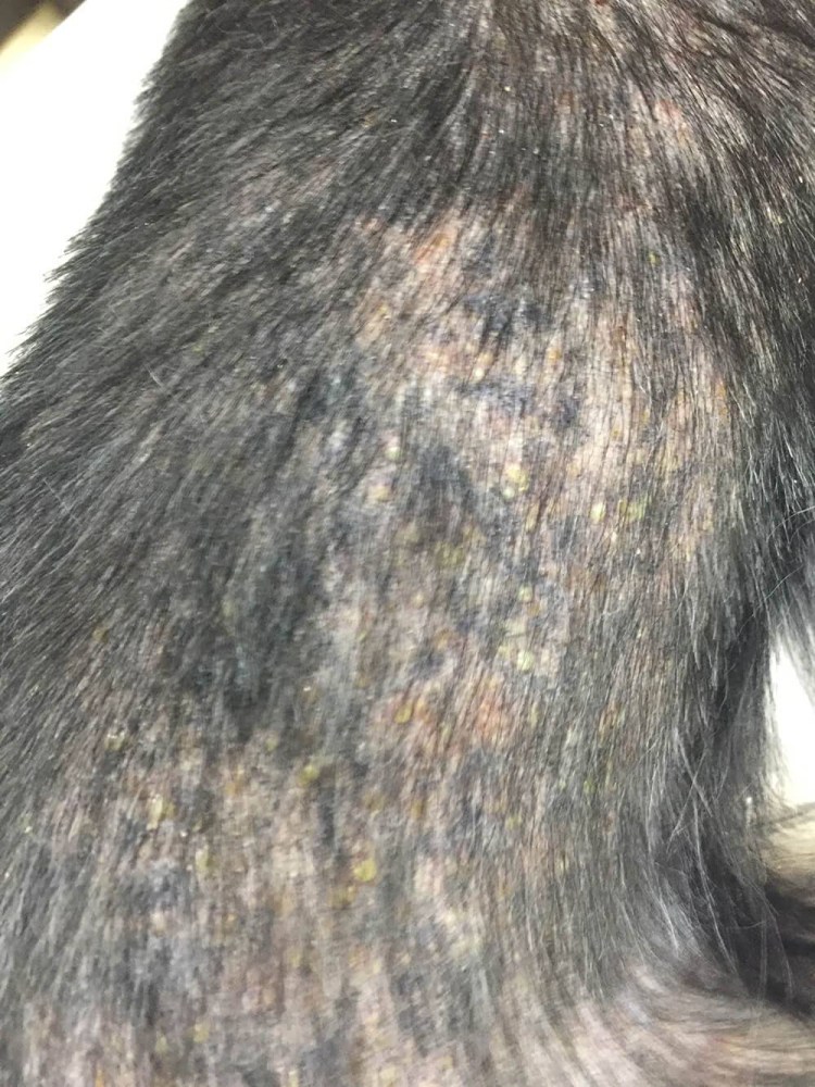 Малассезионный дерматит