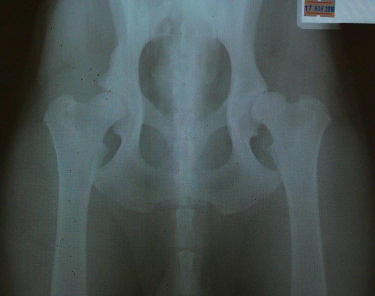 Пироплазмоз немецкой овчарки