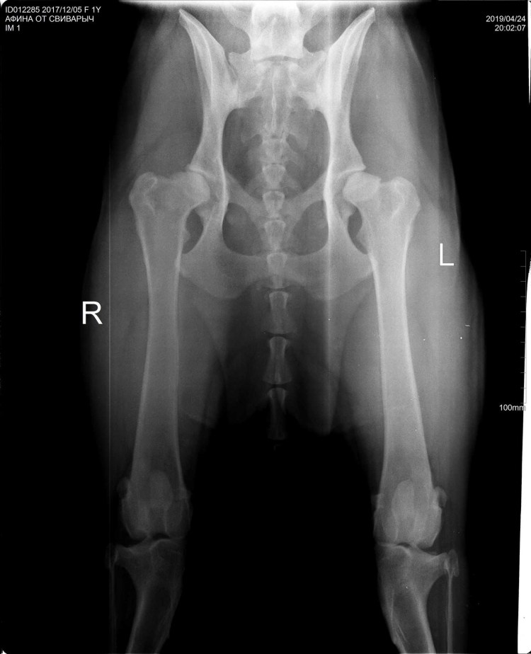 Вывих тазобедренного рентген