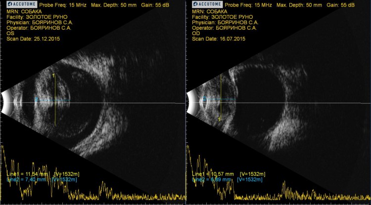 Кератит увеит иридоциклит