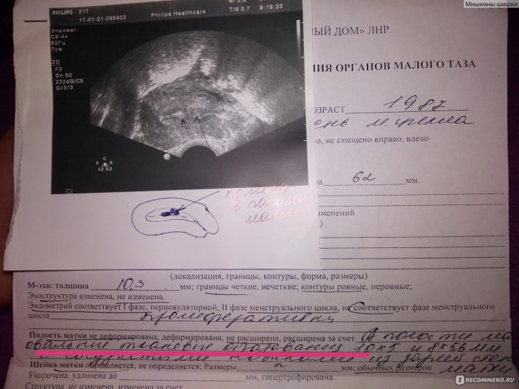 Как определить бешенство у кота