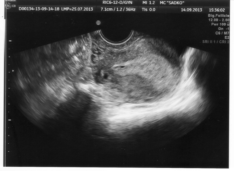 Беременная тайская кошка