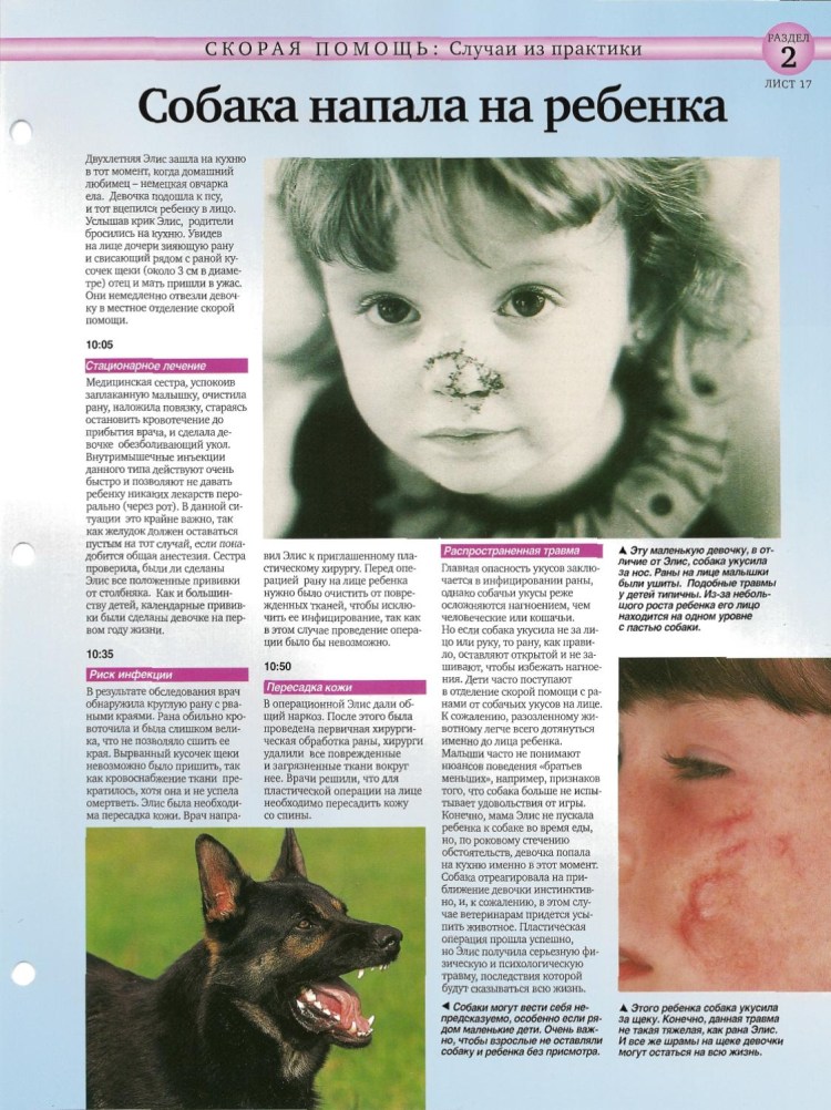 Собака вцепилась в руку