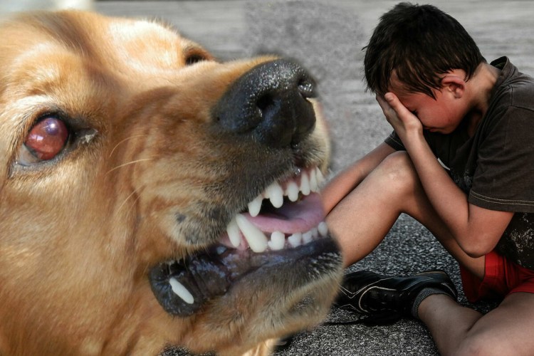 Собаки которые набрасываются на детей