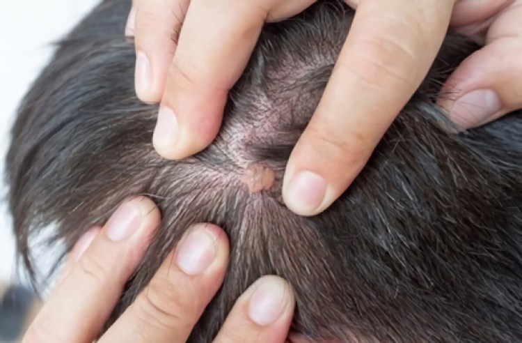 Листовидная пузырчатка у собак