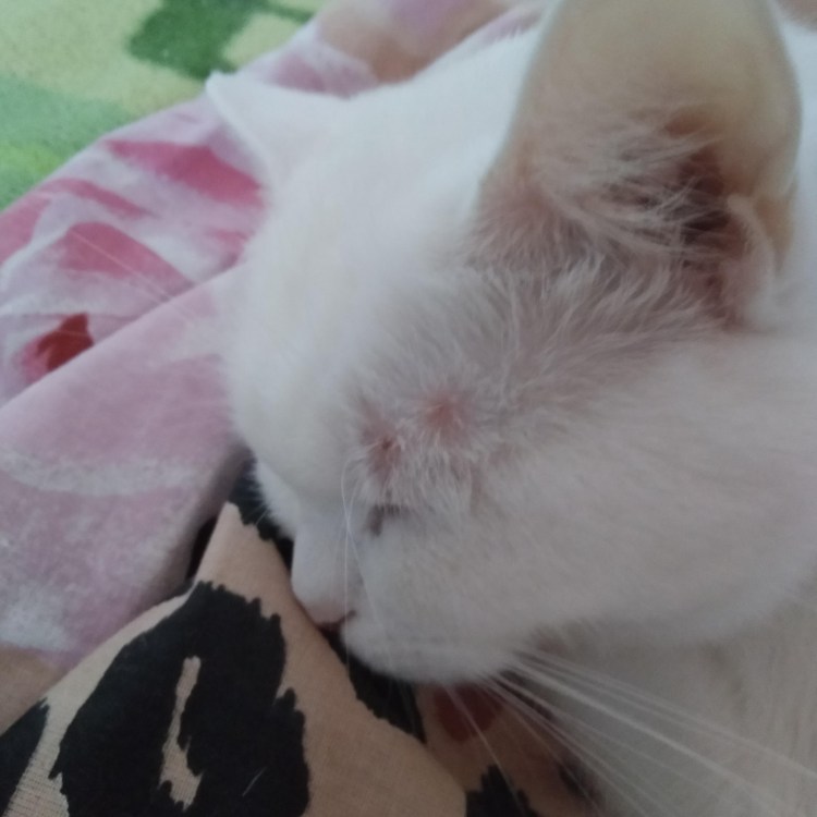 Саркоптическая чесотка