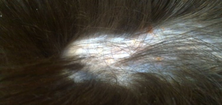 Облысел хвост у хорька