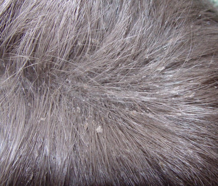 Клещ хейлетиелла перхоть