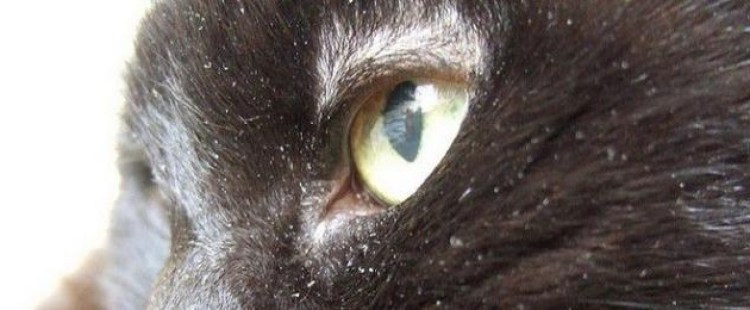 Перхоть сразу после мытья головы