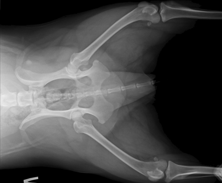 Психосоматика дисплазии тазобедренных суставов у ребенка