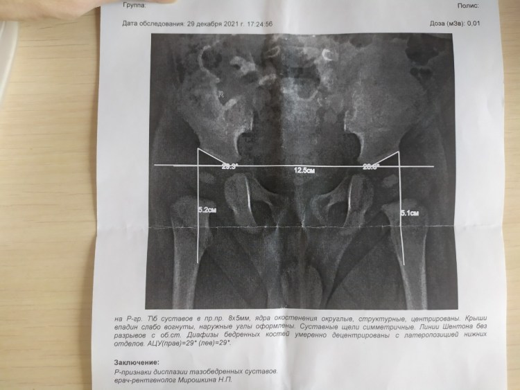 Рентген сустав артроз у собаки