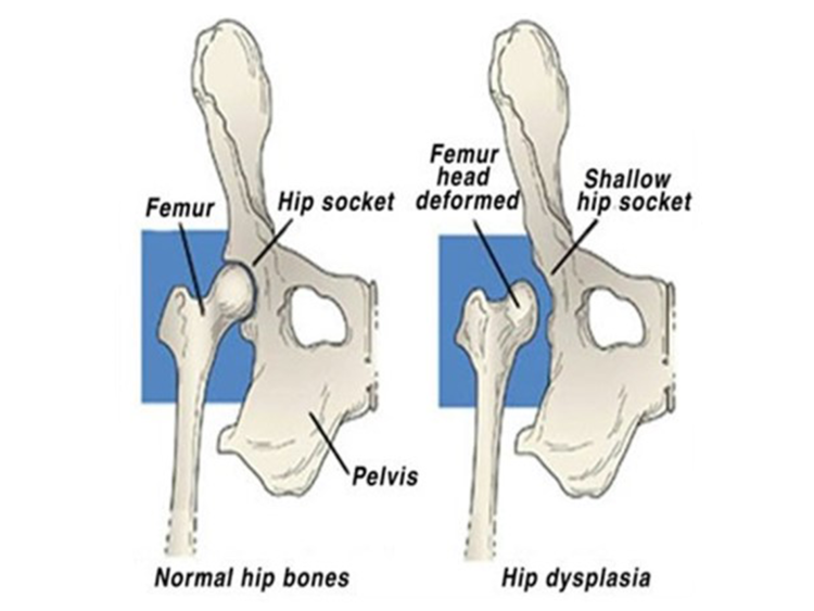 Рентген ТЗС ребенка норма