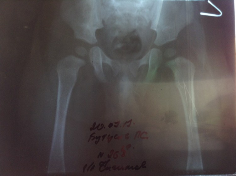 Дисплазия исбздоровой собаки