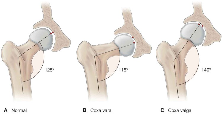 Дисплазия ТБС У кошек рентген