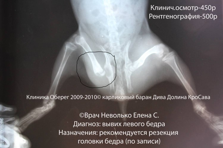 Тазобедренный сустав вертлужная