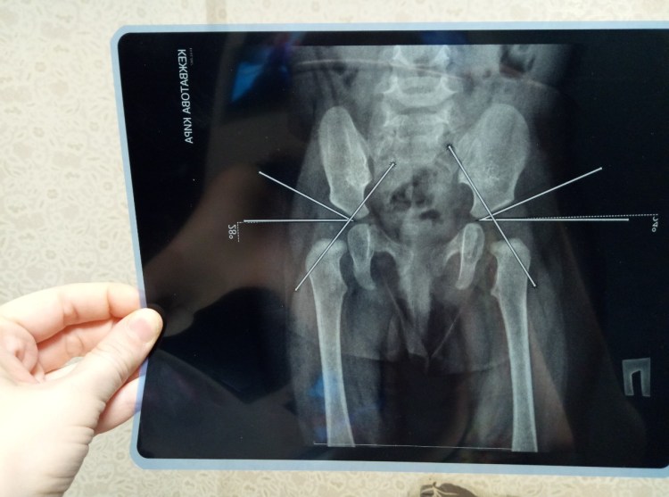 ТБС сустав тазобедренный