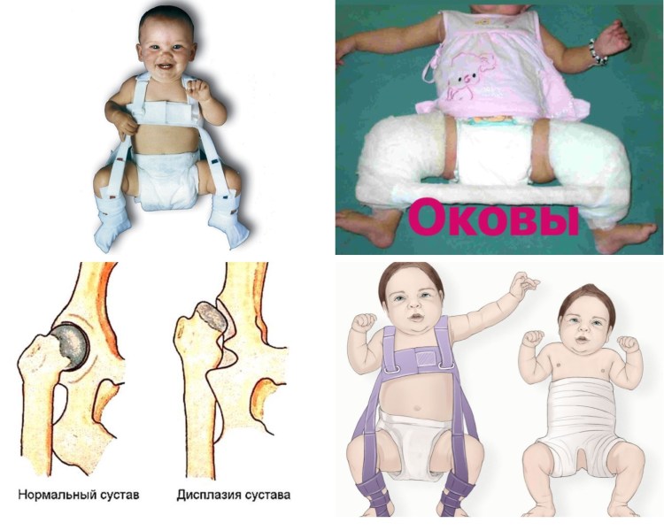 Шеечно диафизарный угол шейка бедра