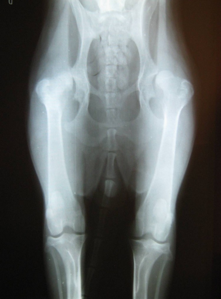 Дисплазия тазобедренных суставов у взрослых рентген