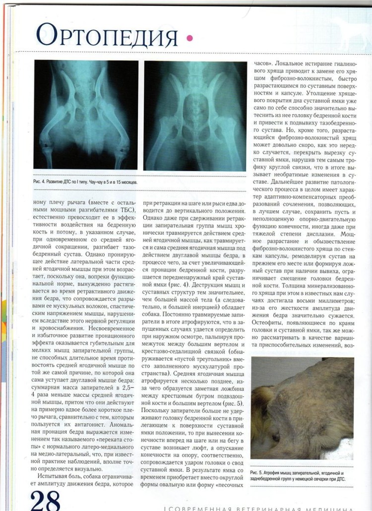 Врожденный вывих бедра ограничение отведения