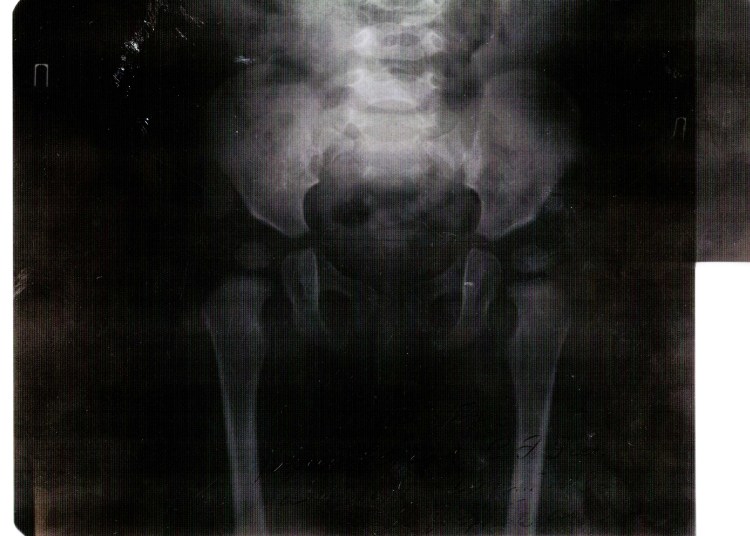 Дисплазия тазобедренного сустава у собак рентген