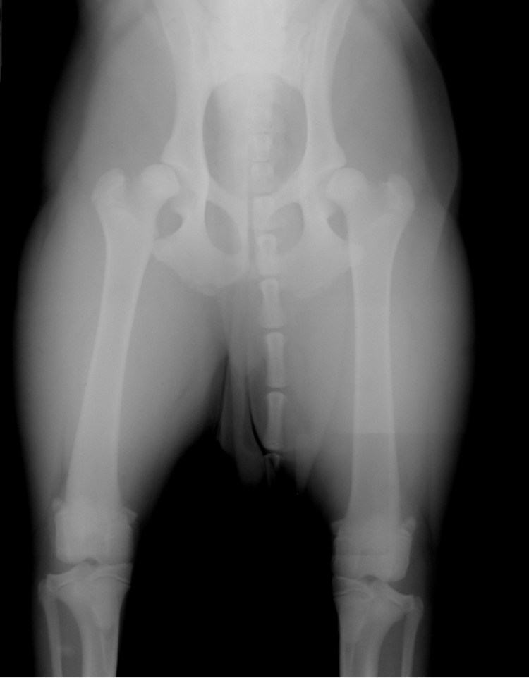 Кокса вара тазобедренного сустава рентген