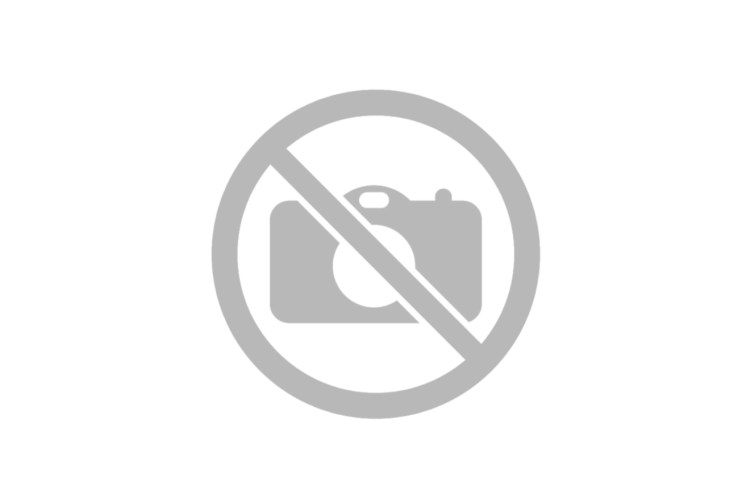 Кокса Вальга тазобедренного сустава рентген