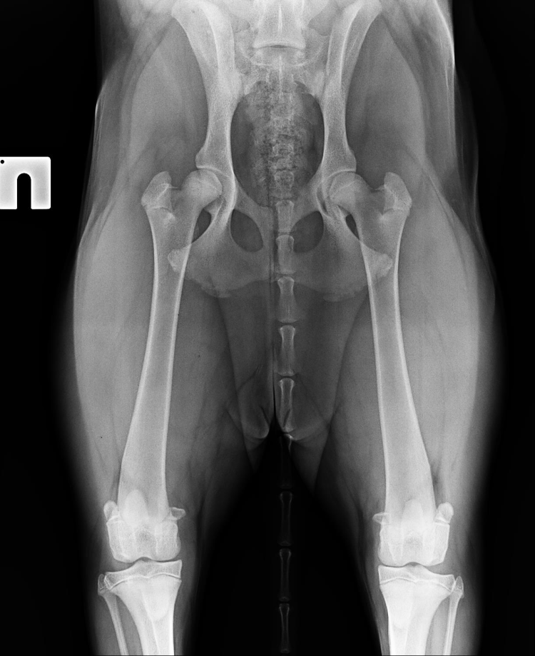Рентген ТБС при дисплазии