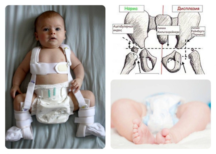 Вывих шейки бедра у котенка